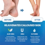 Imperial Feet Callus Softener Μαλακτικό Spray Υπερκερατώσεων με Urea 150ml