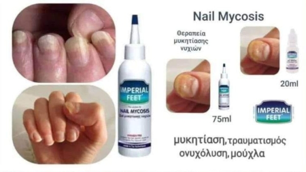 Imperial Feet Nail Mycosis Gel Μυκητίασης Νυχιών 75ml