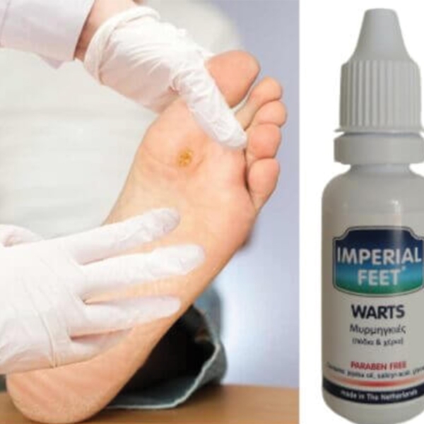 Imperial Feet WARTS για Μυρμηγκιές Πόδια & Χέρια 20ml