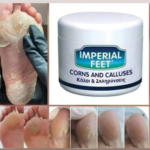 Συσκευασία Imperial Feet Corns & Calluses 75ml