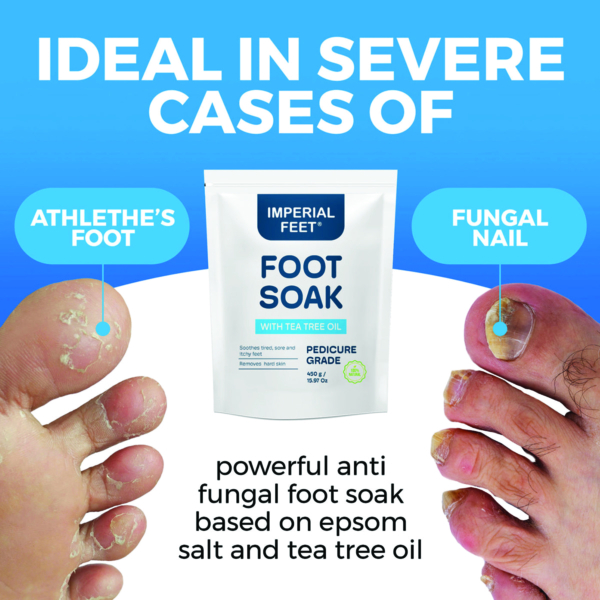 Imperial Feet Foot Soak 450g σχεδιασμένο για σοβαρές περιπτώσεις όπως πόδι του αθλητή και μυκητιάσεις νυχιών.